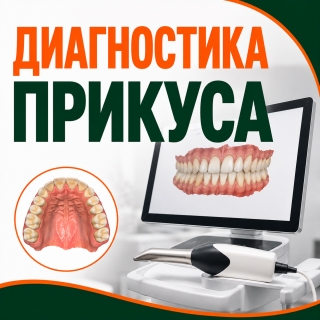 Диагностика прикуса и внутриротовое сканирование