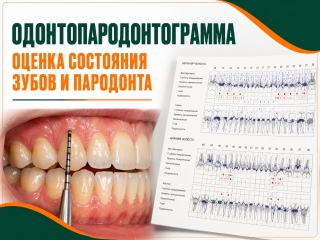 Однотопародонтограмма