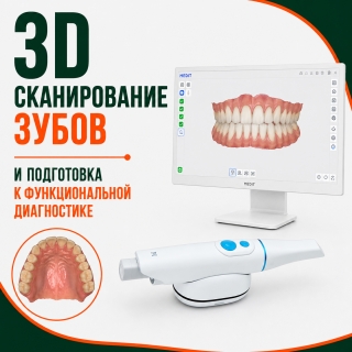 3D сканирование зубов и подготовка к гнатологическому анализу