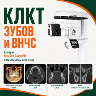КЛКТ зубных рядов и ВНЧС