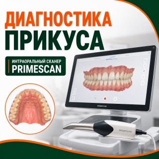 Диагностика прикуса и внутриротовое сканирование