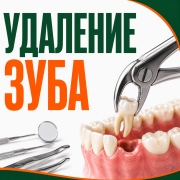 Удаление зуба на Дубровке