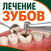 Лечение зубов на Дубровке