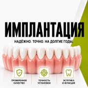 Имплантация зубов Дубровка