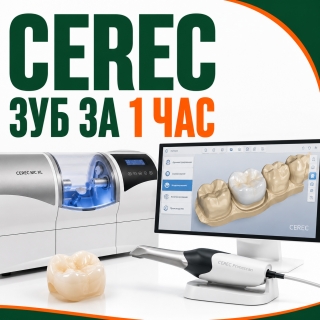 Зуб за 1 час - технология CEREC. Фрезерный станок CEREC MC XL 