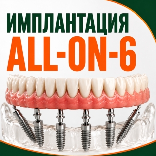 3D сканирование при беззубой челюсти