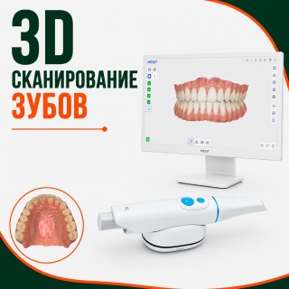 3D сканирование зубов