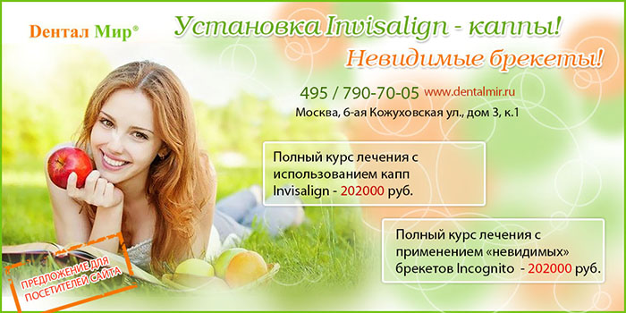 Лечение невидимыми брекетами