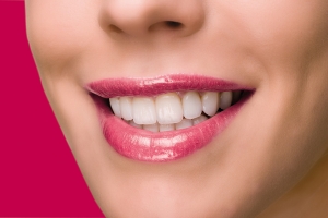 Керамические виниры e.max в полости рта