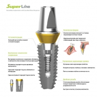 Имплантат Dentium Superline