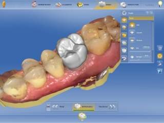 Моделирование зубов в программе