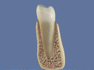 Морфология альвеолярной кости после удаления зуба. Резорбция костной ткани.