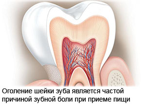 Зуб реагирует на кислое: что делать и какие причины